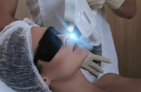 Young Woman Receiving IPL. Photo Facial Therapy | La Vida Laser & Aesthetics Institute in Houston, TX