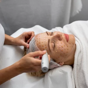A Lady getting treatment on face by adevice | Fibroblast Plasma Lift Certification Training | La Vida Laser & Aesthetics Institute