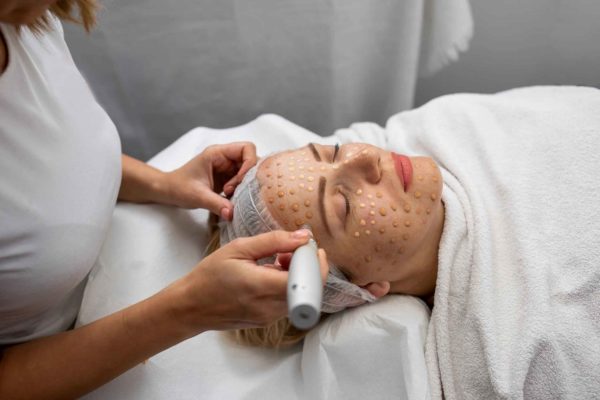 A Lady getting treatment on face by adevice | Medical Level Aesthetician Courses | La Vida Laser & Aesthetics Institute