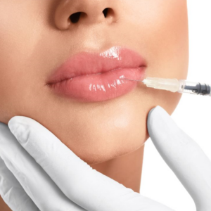 Dermal Fillers Course at La Vida Laser & Aesthetics Institute