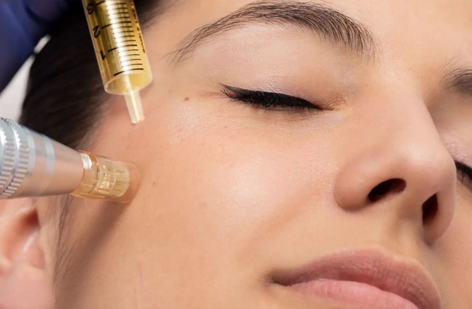 Microneedling Collagen Induction Therapy |