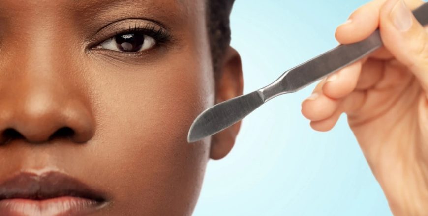 dermaplaning-and_chemical_peel-lavidaai-Houston-TX