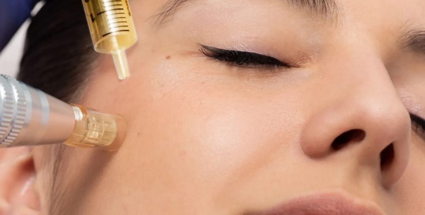 microneedling_collagen_induction_therapy-lavidaai-Houston-TX